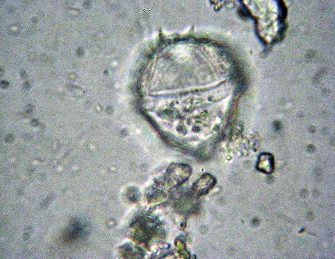 Identificazione di un dinoflagellato